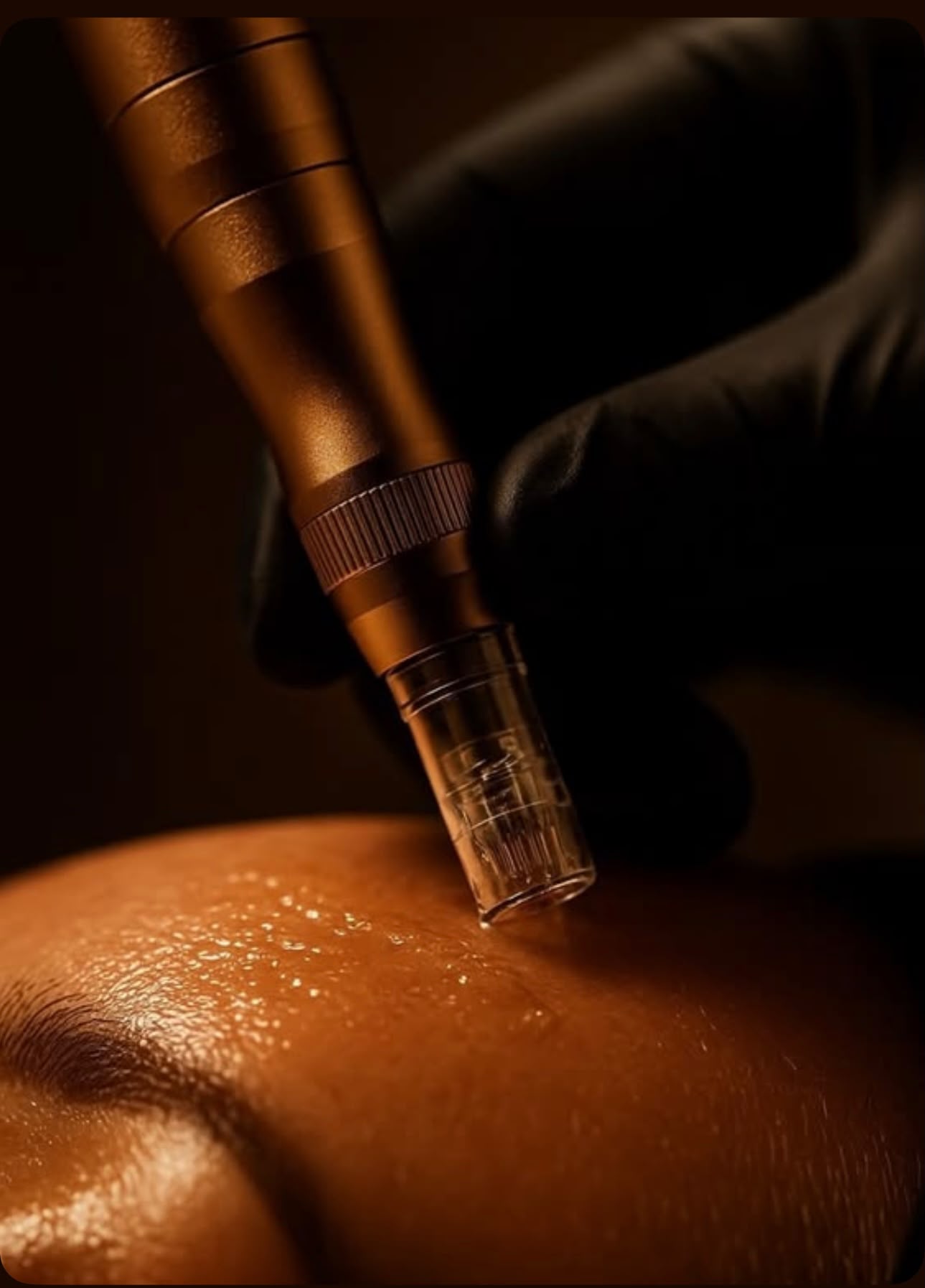 Ritual of Needling